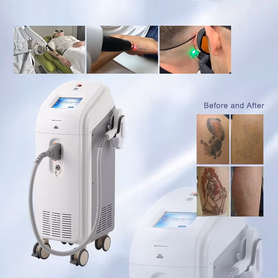 Long Life High Quality Tattoo Oat Removal Qswitched ND YAG Q-Switched Laser Machine